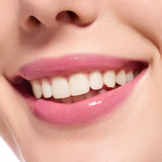 Click on photo to zoom it ESSENCE EXTREME SHINE LIP GLOSS 103 PRETTY IN PINK 5ML