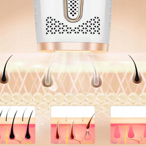FitbyMed BHRL-04 IPL Hair Removal Device with Cooling Function, White