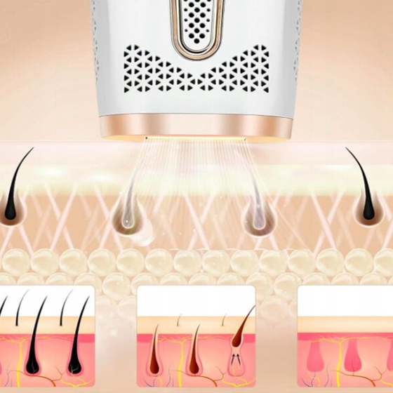 FitbyMed BHRL-04 IPL Hair Removal Device with Cooling Function, White