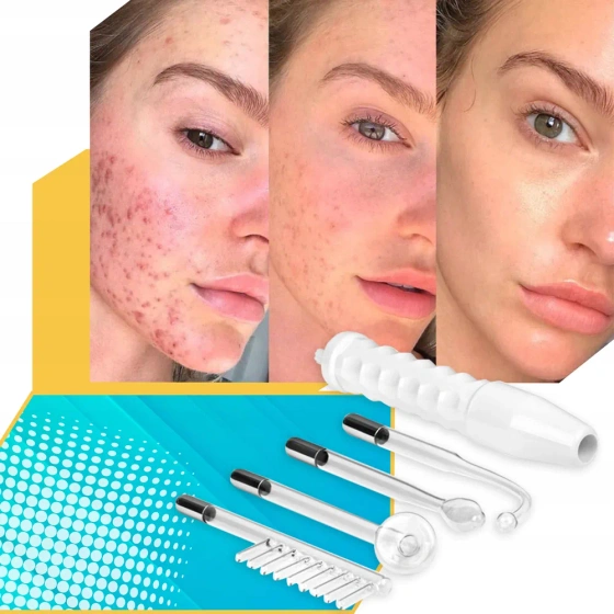 Click on photo to zoom it Darsonval Facial, Body and Head Skin Care Device + 4 Electrodes U035