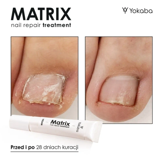Click on photo to zoom it Yokaba Matrix Nail Repair Treatment Serum 15ml