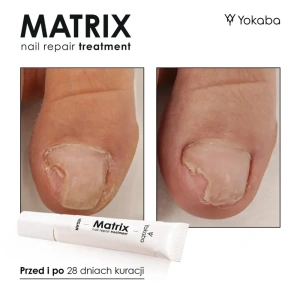 Yokaba Matrix Nail Repair Treatment Serum 15ml