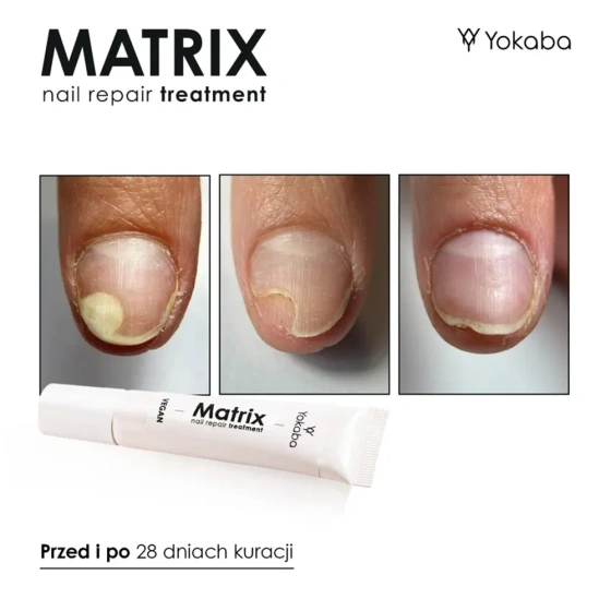 Click on photo to zoom it Yokaba Matrix Nail Repair Treatment Serum 15ml