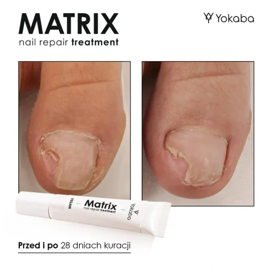Click on photo to zoom it Yokaba Matrix Nail Repair Treatment Serum 15ml